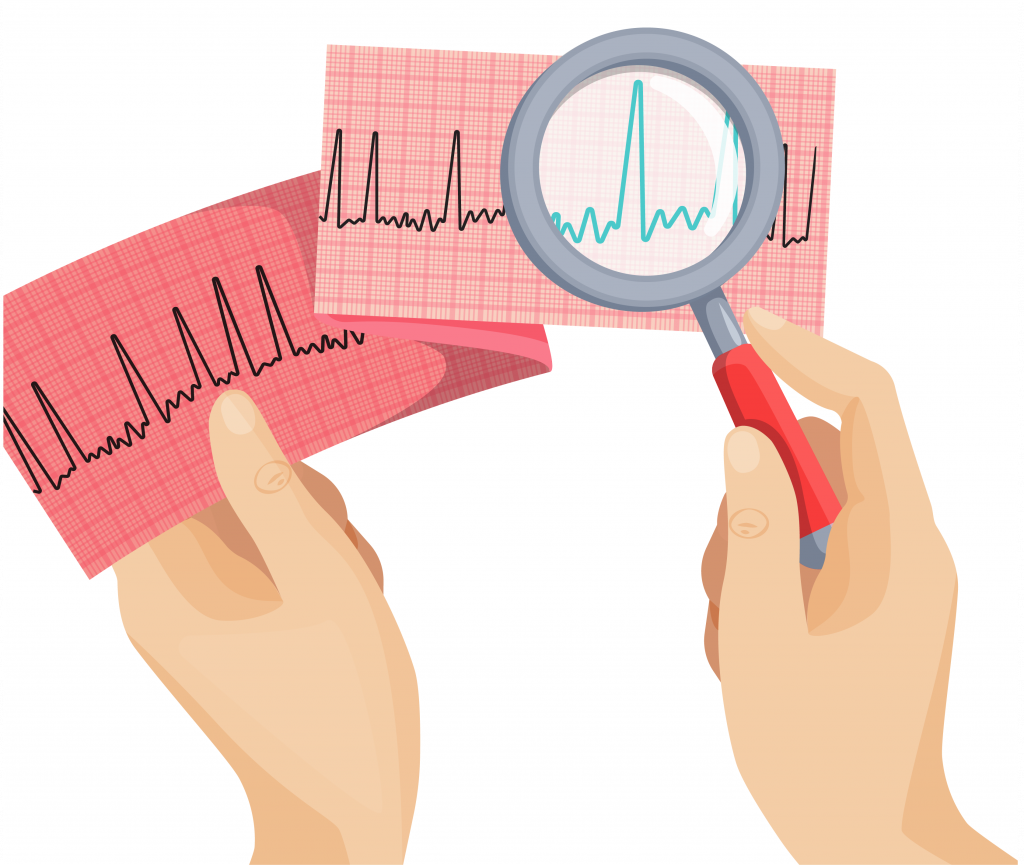 Os diferentes tipos de Afib | Questões de fibrilhação auricular