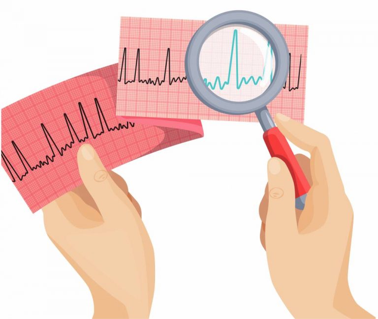 the-different-types-of-afib-atrial-fibrillation-matters