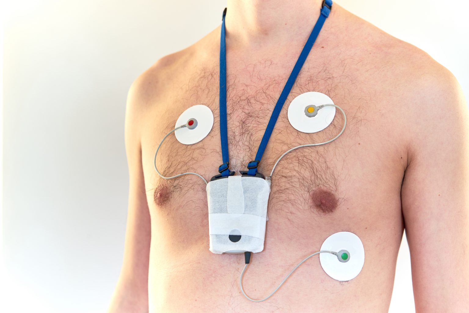 Useful Atrial Fibrillation Tests | Atrial Fibrillation Matters