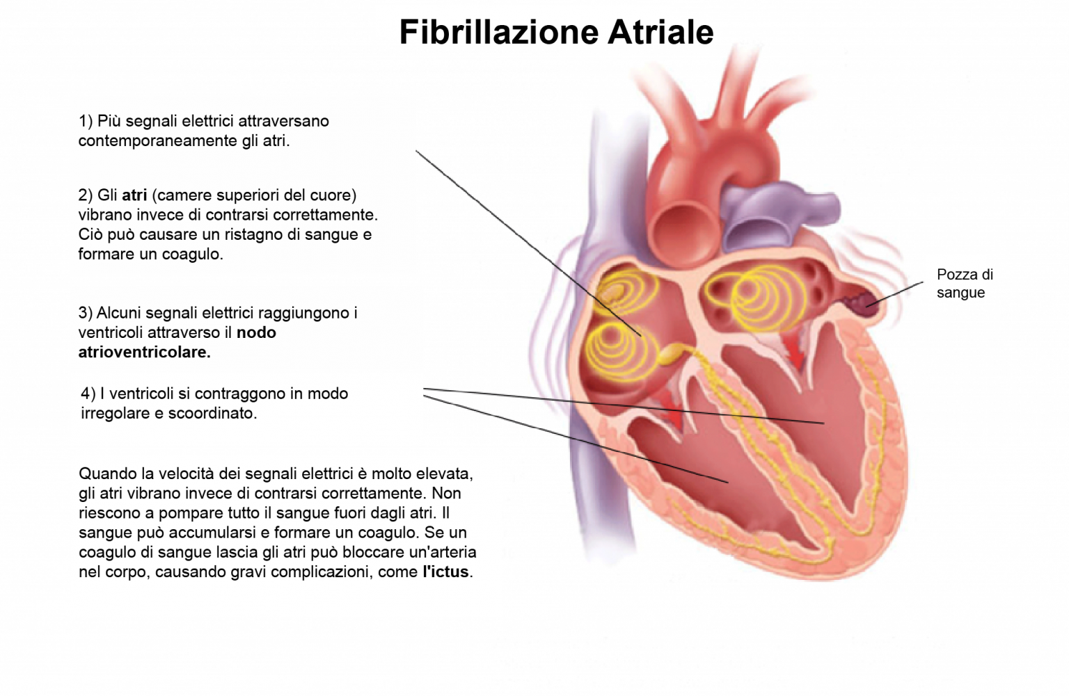 E Il Cuore Quando D'un Ultimo Battito